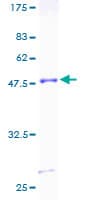 Human RHOC Protein (Recombinant GST)