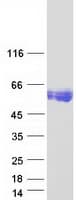 Human CEAL2 / CEACAM16 Protein (Recombinant Myc-DDK (Flag))