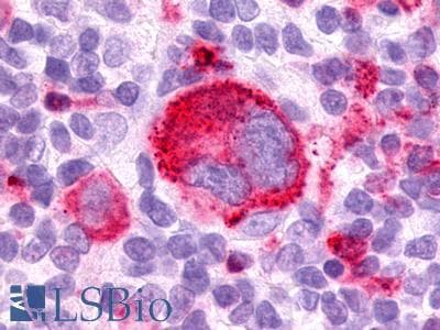 PathPlus™ GPR25 Antibody (N-Terminus)