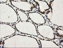 PYCRL Antibody (clone OTI8H6)
