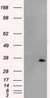 Monoclonal Mouse anti-Human AKR1A1 Antibody (clone OTI8H2, IHC, WB)