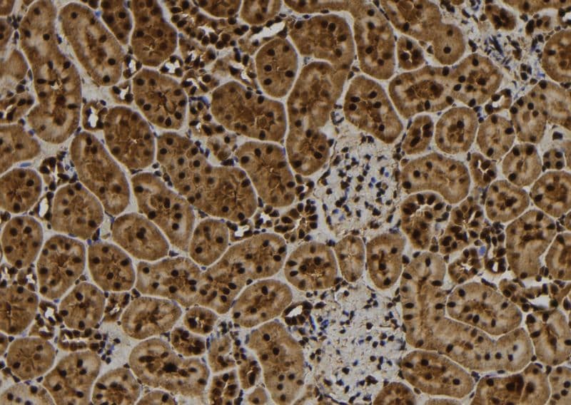 Polyclonal Rabbit anti-Human TNFAIP3 / A20 Antibody (IHC, IF, WB)