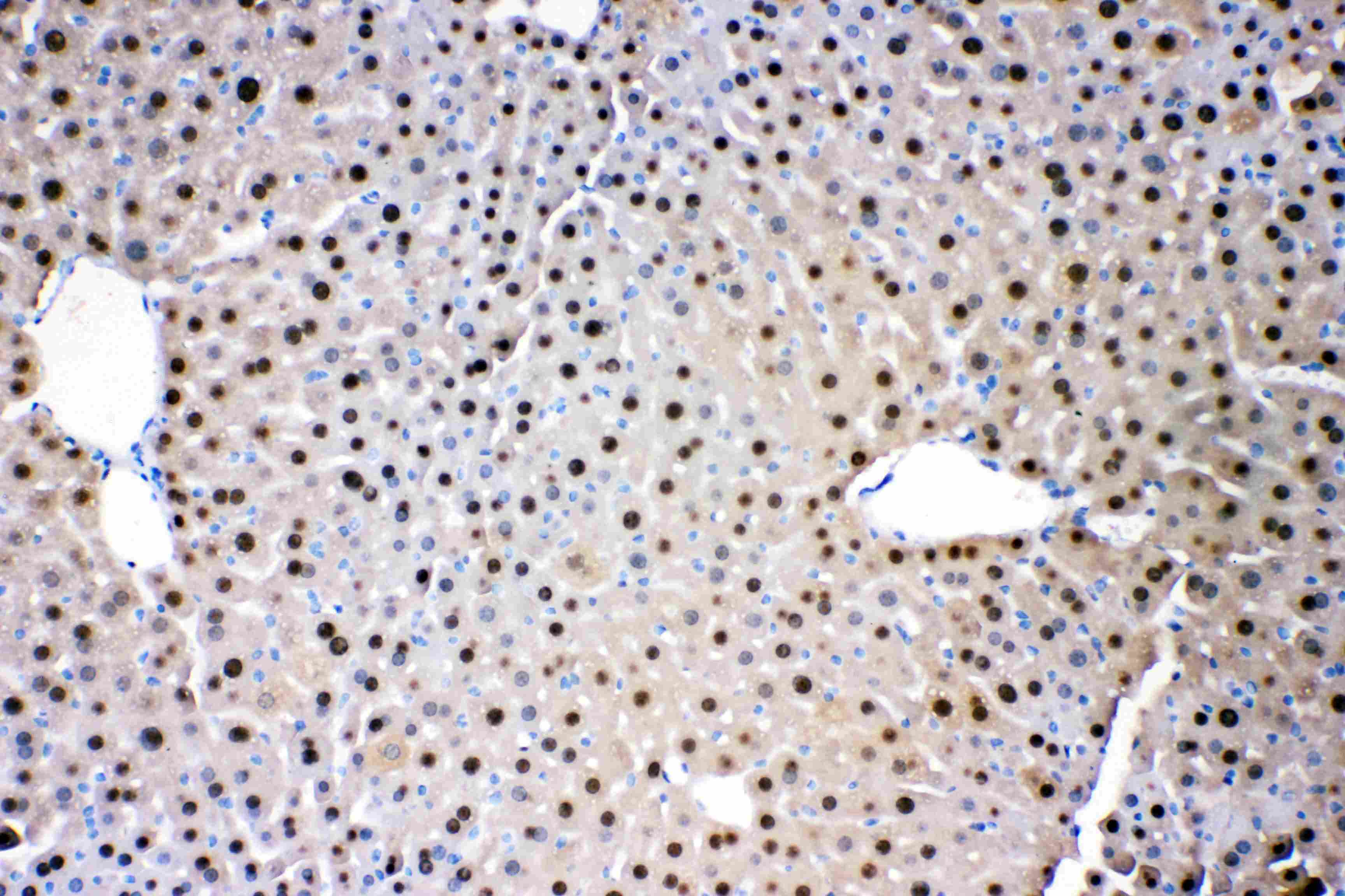 Polyclonal Rabbit anti-Human ADK / Adenosine Kinase Antibody (IHC, WB)