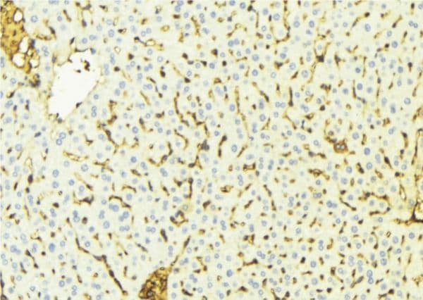 VDAC1 / PORIN Antibody