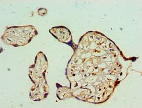 Polyclonal Rabbit anti-Human FUBP3 Antibody (aa65-260, IHC, WB)