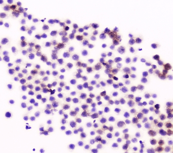 Polyclonal Rabbit anti-Human ITGAL / CD11a Antibody (WB)