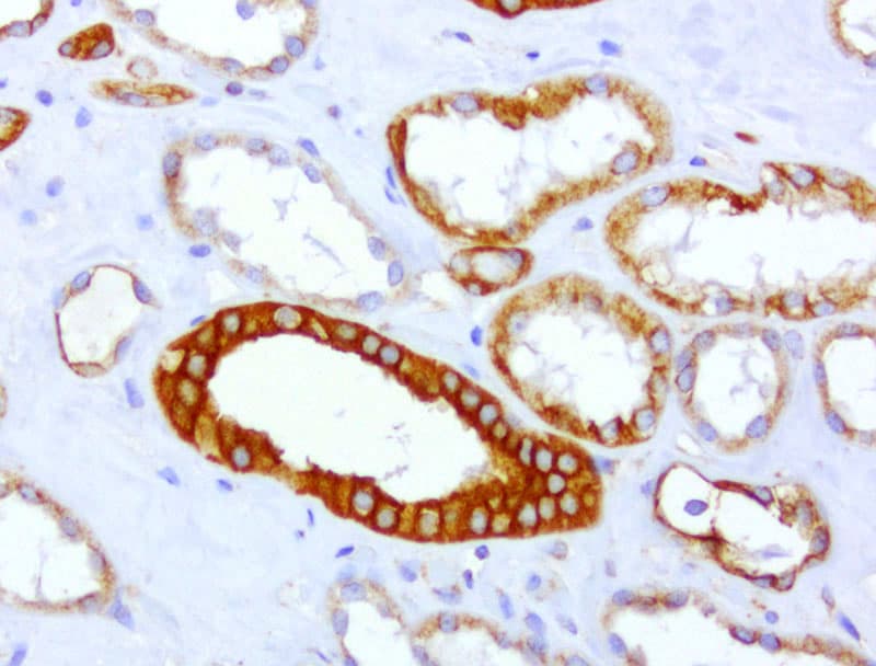 Monoclonal Mouse anti-Human CDH2 / N Cadherin Antibody (clone UMAB23, IHC, IF, WB)