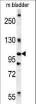 IHC-plus™ DIS3 Antibody (aa295-323)