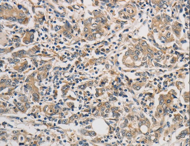 PTPN11 / SHP-2 / NS1 Antibody