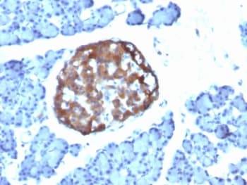 CHGA / Chromogranin A Antibody (clone CHGA/798)