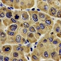 DLD / Diaphorase / E3 Antibody