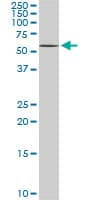 DPH2 Antibody (clone 5B10)