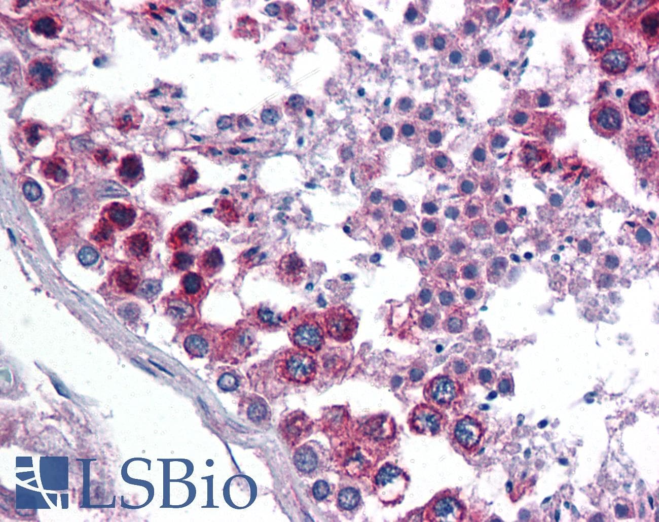 IHC-plus™ TXNDC1 / TMX1 Antibody (aa269-280)