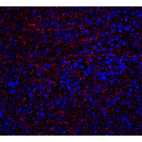 TNFRSF10A / DR4 Antibody