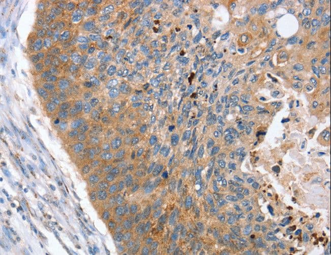 REG3A Antibody