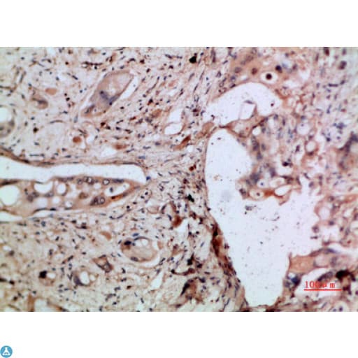 CXCL5 Antibody