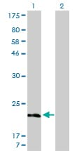 MFSD7 / MYL5 Antibody (clone 1C5)