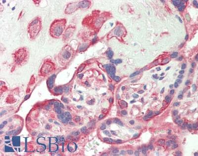 PathPlus™ CSPG4 / NG2 Antibody