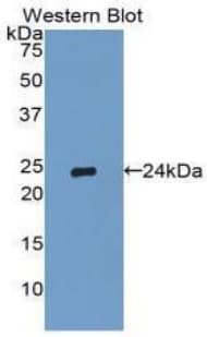 TIMP2 Antibody (aa27-220)
