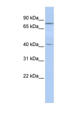 KLHL3 Antibody (C-Terminus)