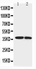 IGFBP1 Antibody (aa170-190)