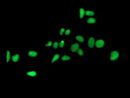 FGFR2 / FGF Receptor 2 Antibody (clone OTI1H5)