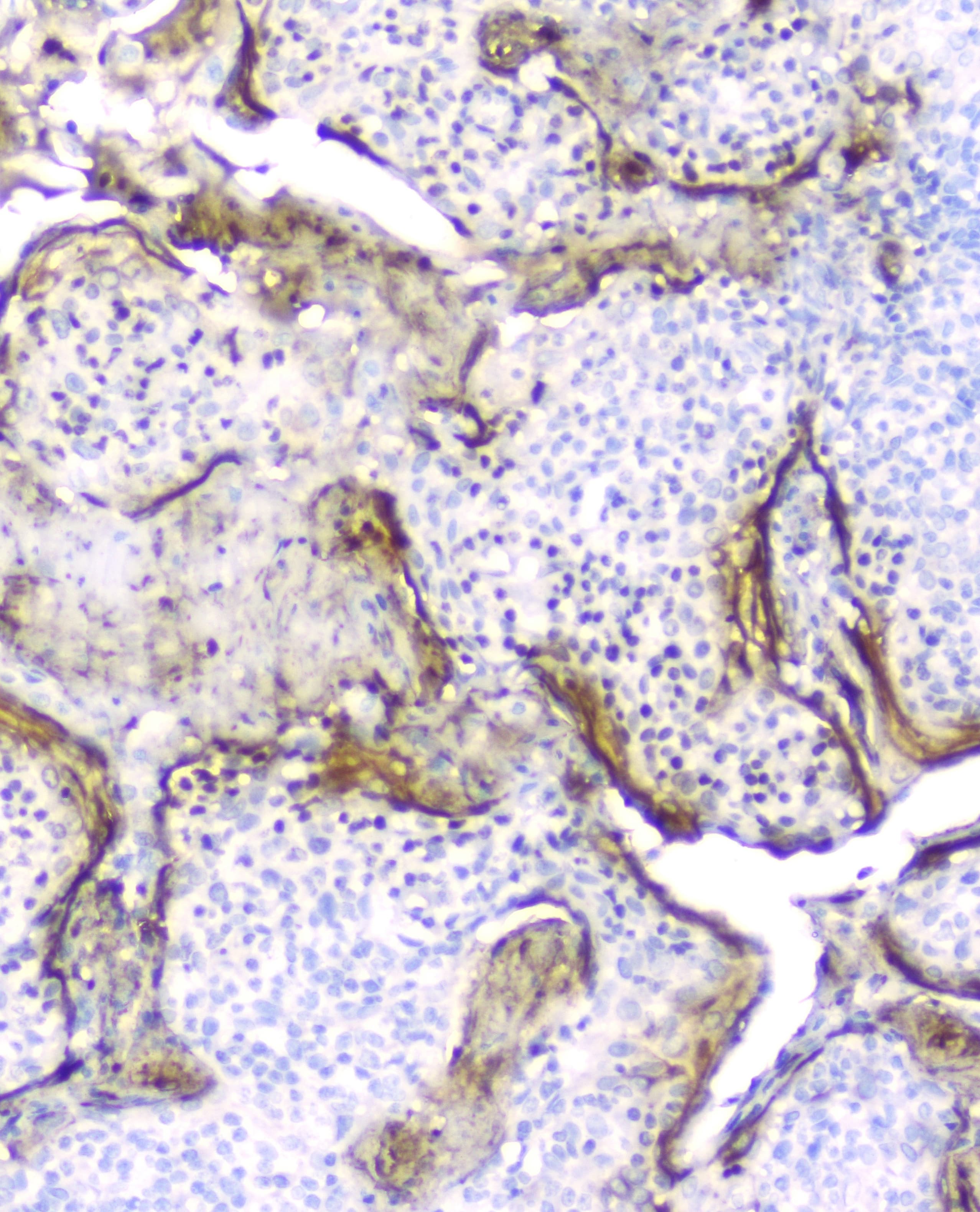 PI3 / Elafin Antibody