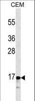 IHC-plus™ CALCA Antibody (aa56-84, clone 406CT21.4.3)