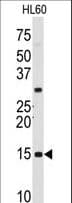 SNRPD1 / SMD1 Antibody (aa69-98)