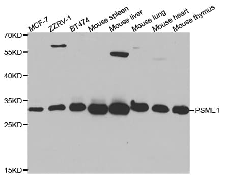 Polyclonal Rabbit anti-Human PSME1 Antibody (IHC, IF, WB)