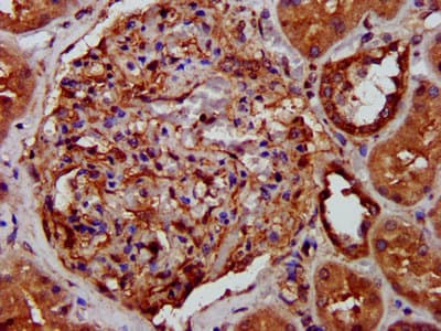 LRPPRC Antibody
