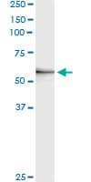 MMP3 Antibody (clone 4C11)