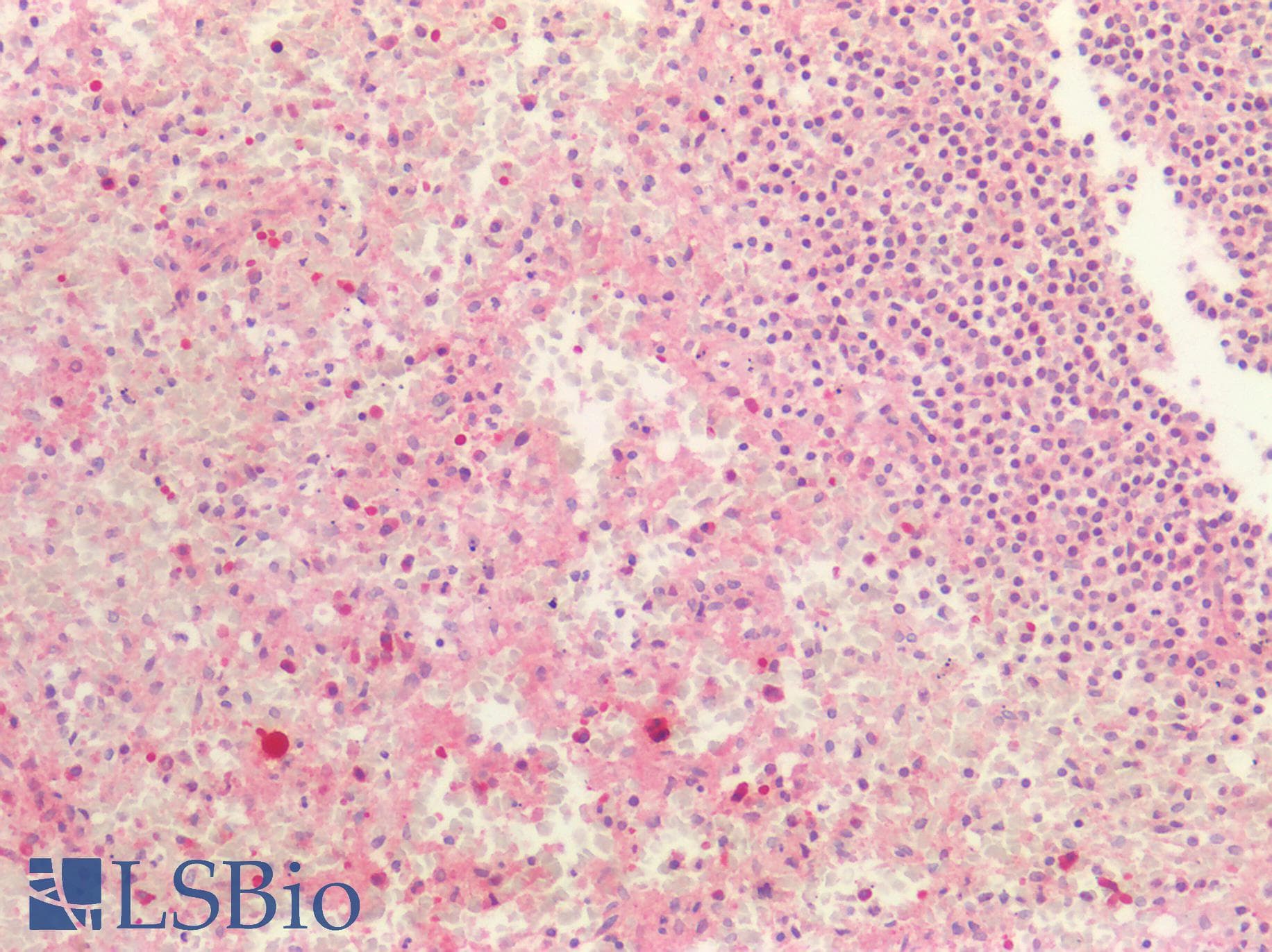IHC-plus™ TGFBR2 Antibody (aa100-150)