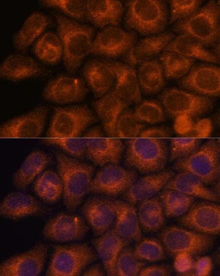 SEC23IP / p125 Antibody