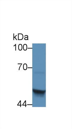 SERPINB4 / SCCA1+2 Antibody (aa60-222)