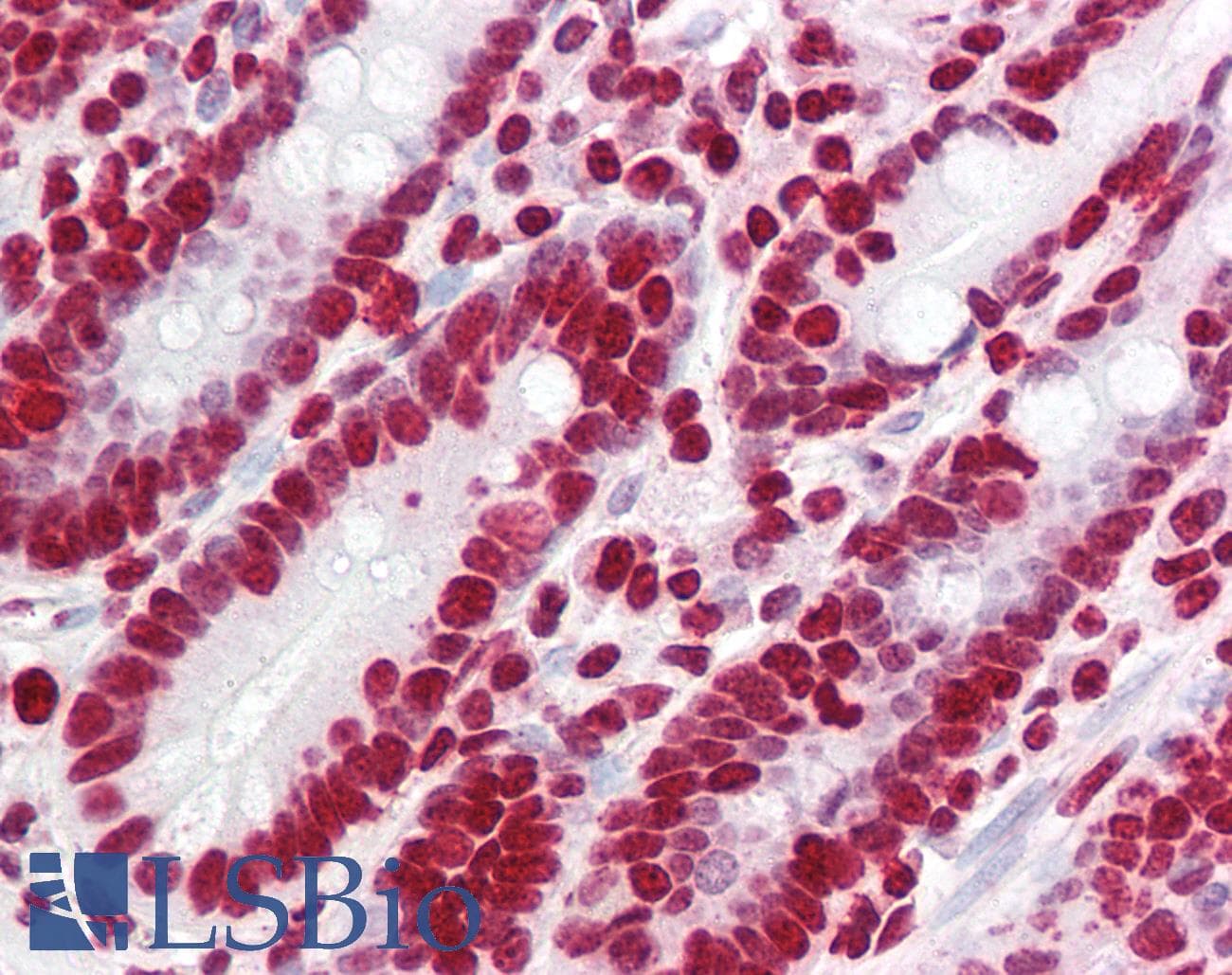 IHC-plus™ Polyclonal Rabbit anti-Human YPEL5 Antibody (IHC, IF, WB)