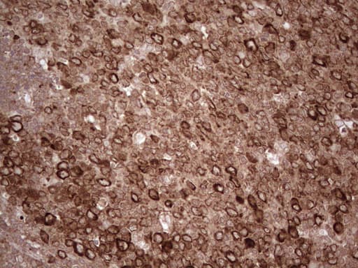 Monoclonal Mouse anti-Human YBX1 / YB1 Antibody (clone OTI11A7, IHC, WB)