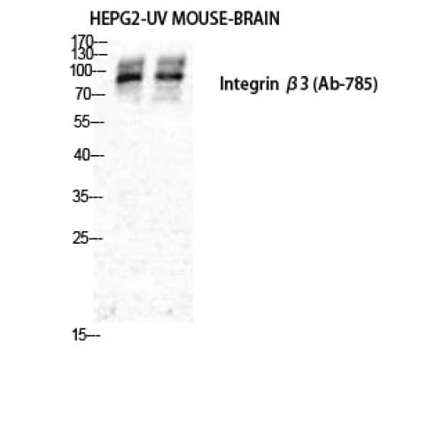 ITGB3 / Integrin Beta 3 / CD61 Antibody (720-800 aa)