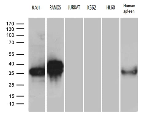 CD79B / CD79 Beta Antibody (clone OTI8A12)