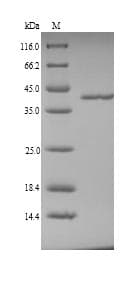 Pig F12 / Factor XII Protein (Recombinant 6His, N-terminus)
