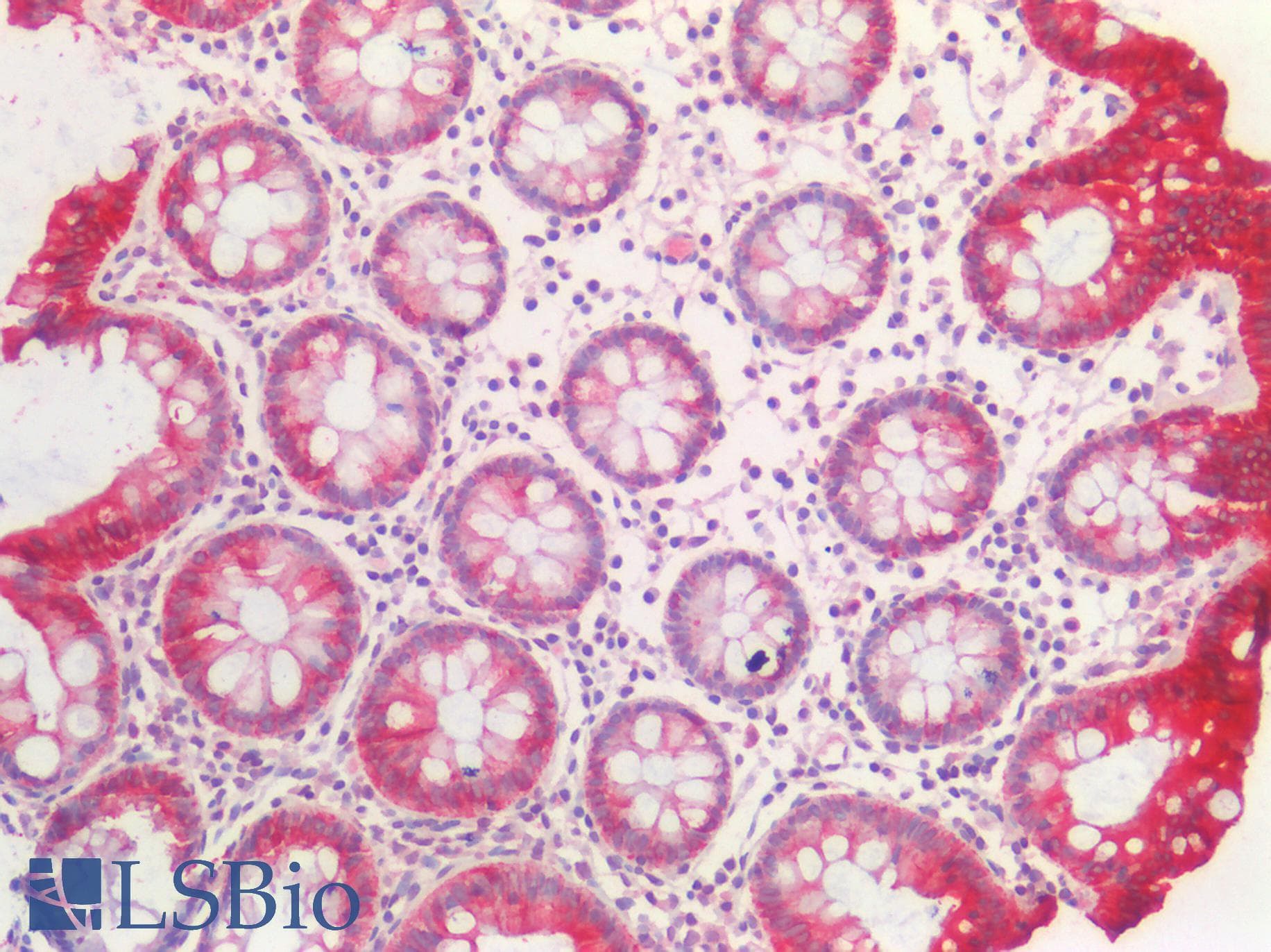 IHC-plus™ Polyclonal Goat anti-Human KRT20 / CK20 / Cytokeratin 20 Antibody (aa107-118, IHC, WB)