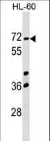 CCIN / Calicin Antibody (aa373-400)