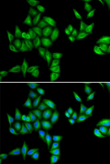 Polyclonal Rabbit anti-Human BTG1 Antibody (IHC, IF, WB)