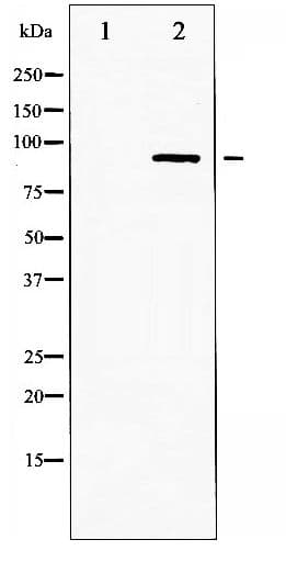 Polyclonal Rabbit anti-Human IKK Alpha+Beta Antibody (phospho-Ser180/181, IHC, WB)