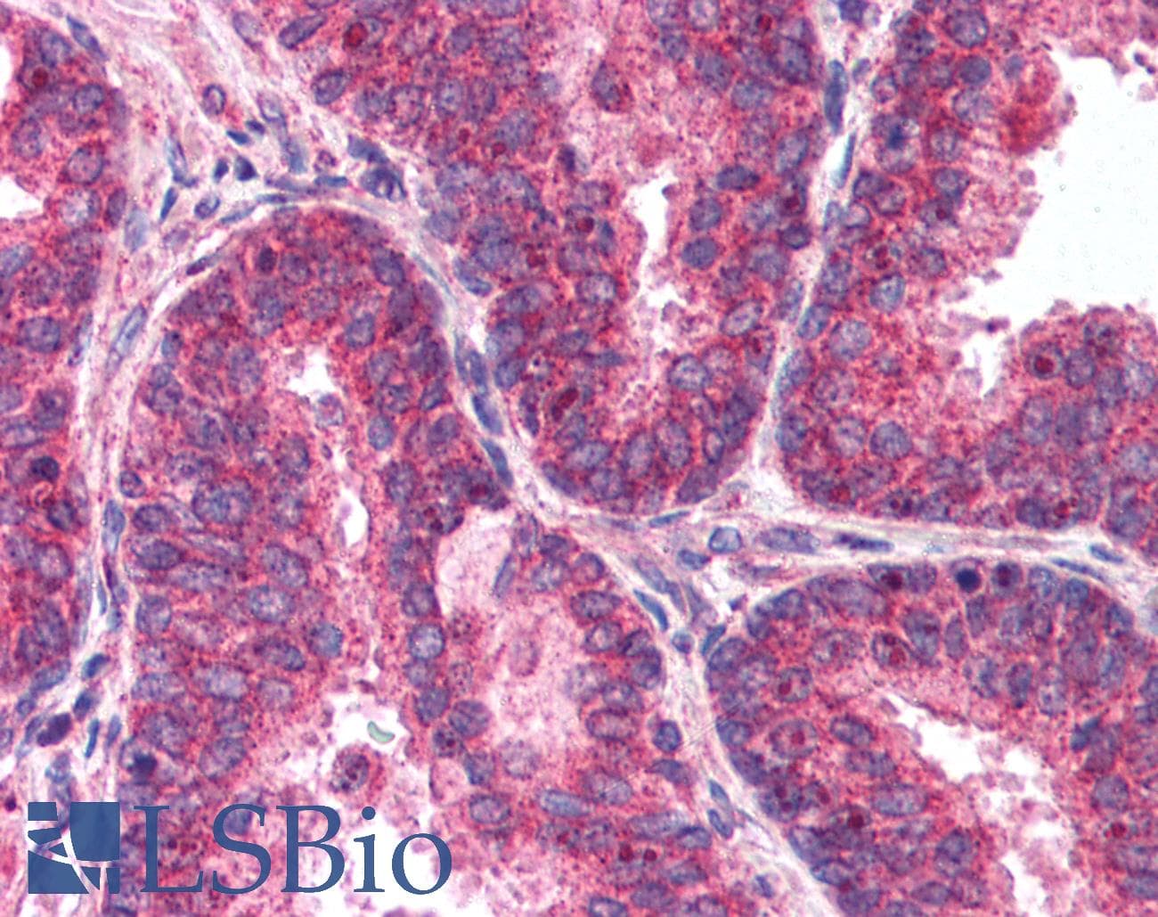 PathPlus™ MTOR Antibody