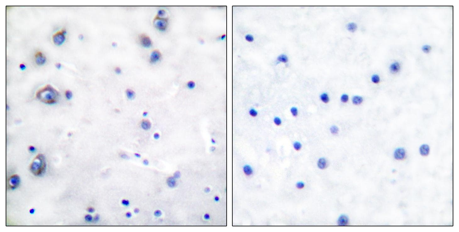 Polyclonal Rabbit anti-Human NTRK2 / TRKB Antibody (p515, IHC, WB)