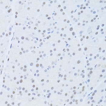POLR2A / RNA polymerase II Antibody