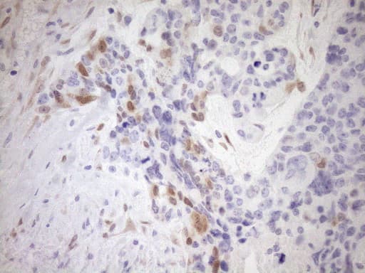 p16INK4a / CDKN2A Antibody (clone OTI5G9)