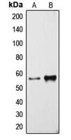 CYP3A4 / Cytochrome P450 3A4 Antibody (Internal)
