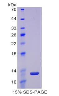 Mouse LOXL2 Protein (Recombinant His)